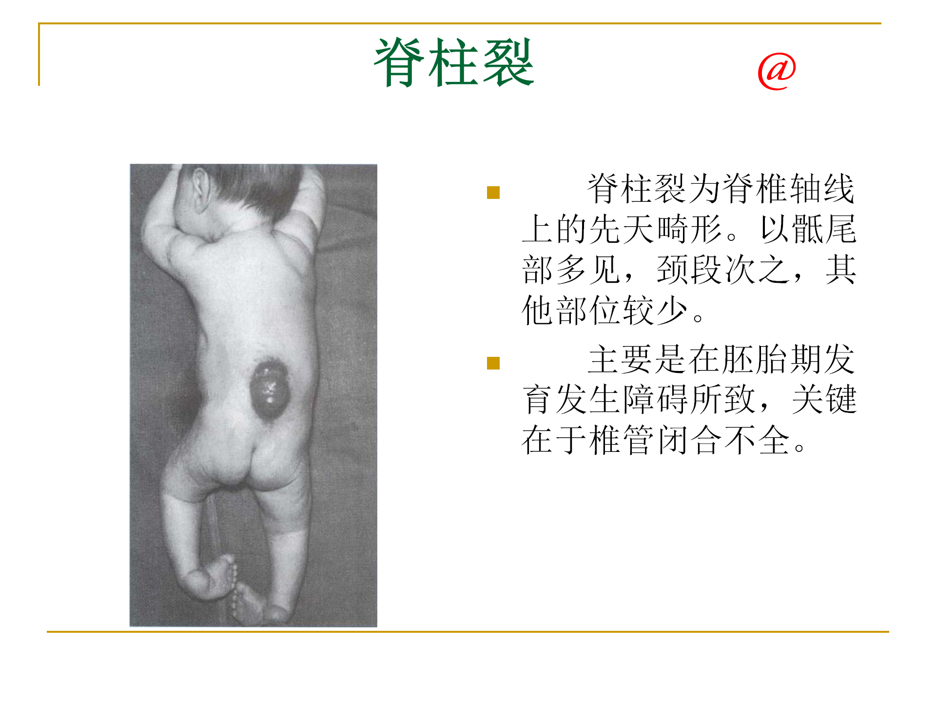 《人体解剖学》--躯干骨解剖_28.png