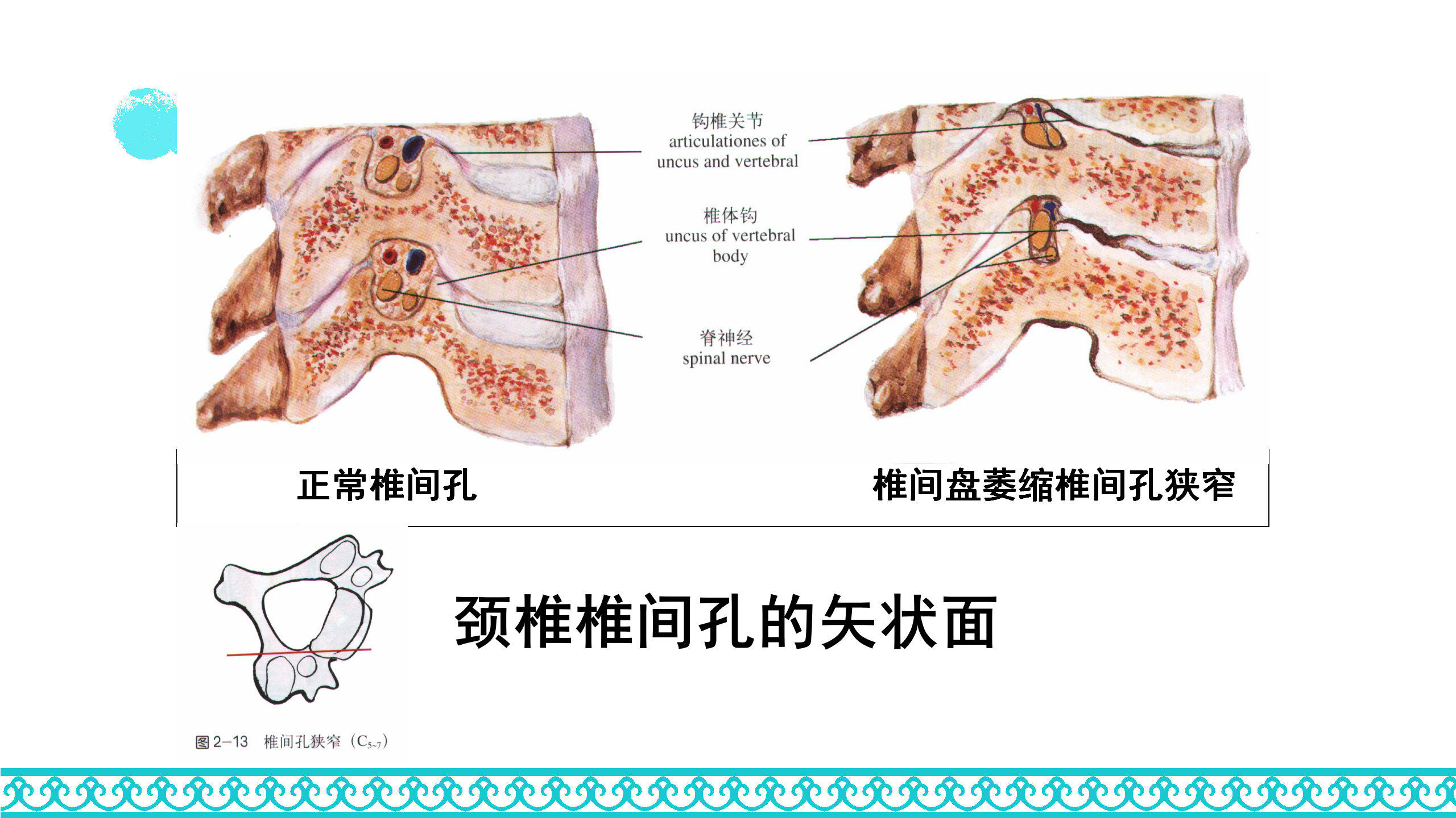颈部解剖_22.png