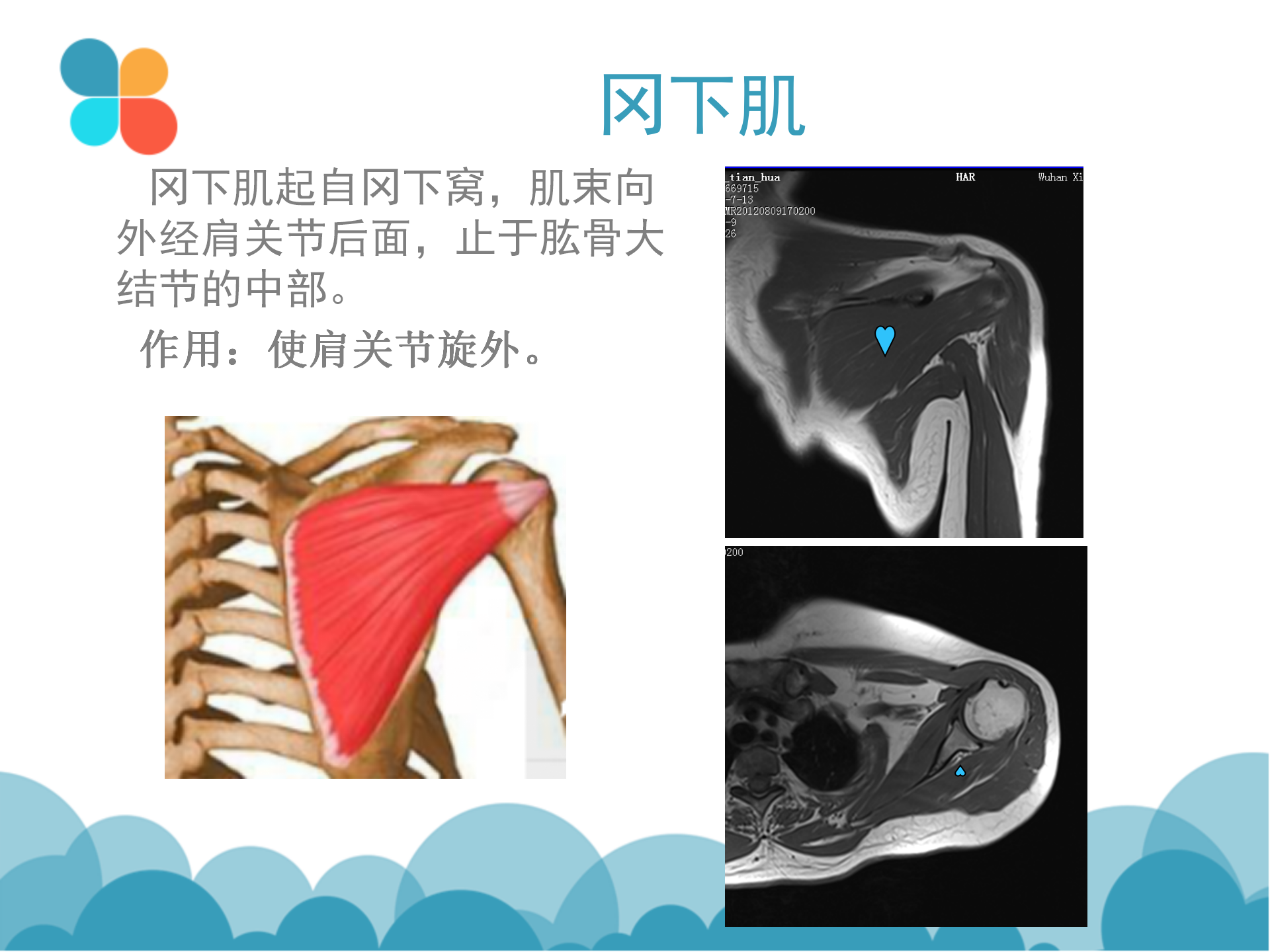 肩袖解剖LY_19.png