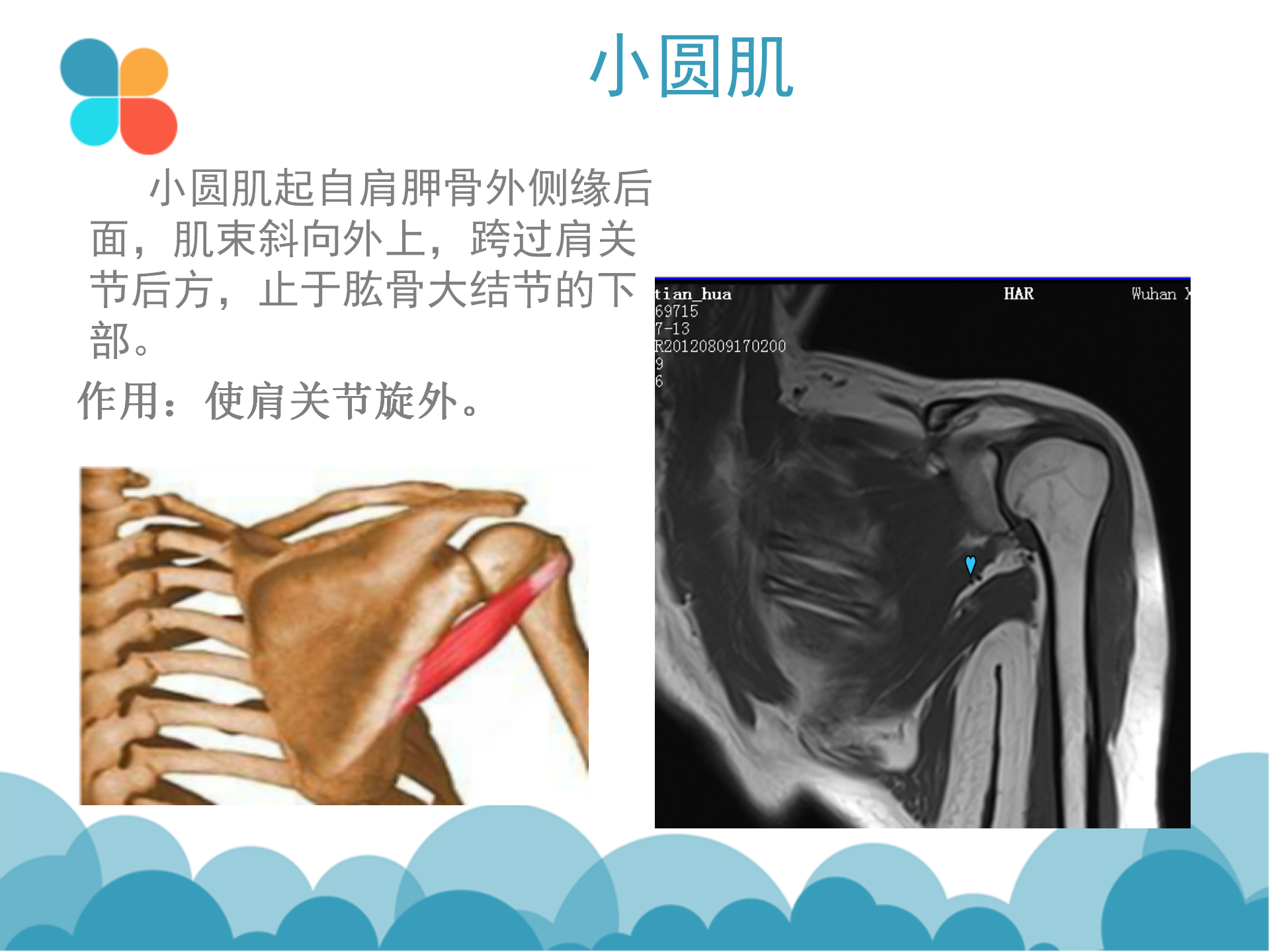 肩袖解剖LY_20.png