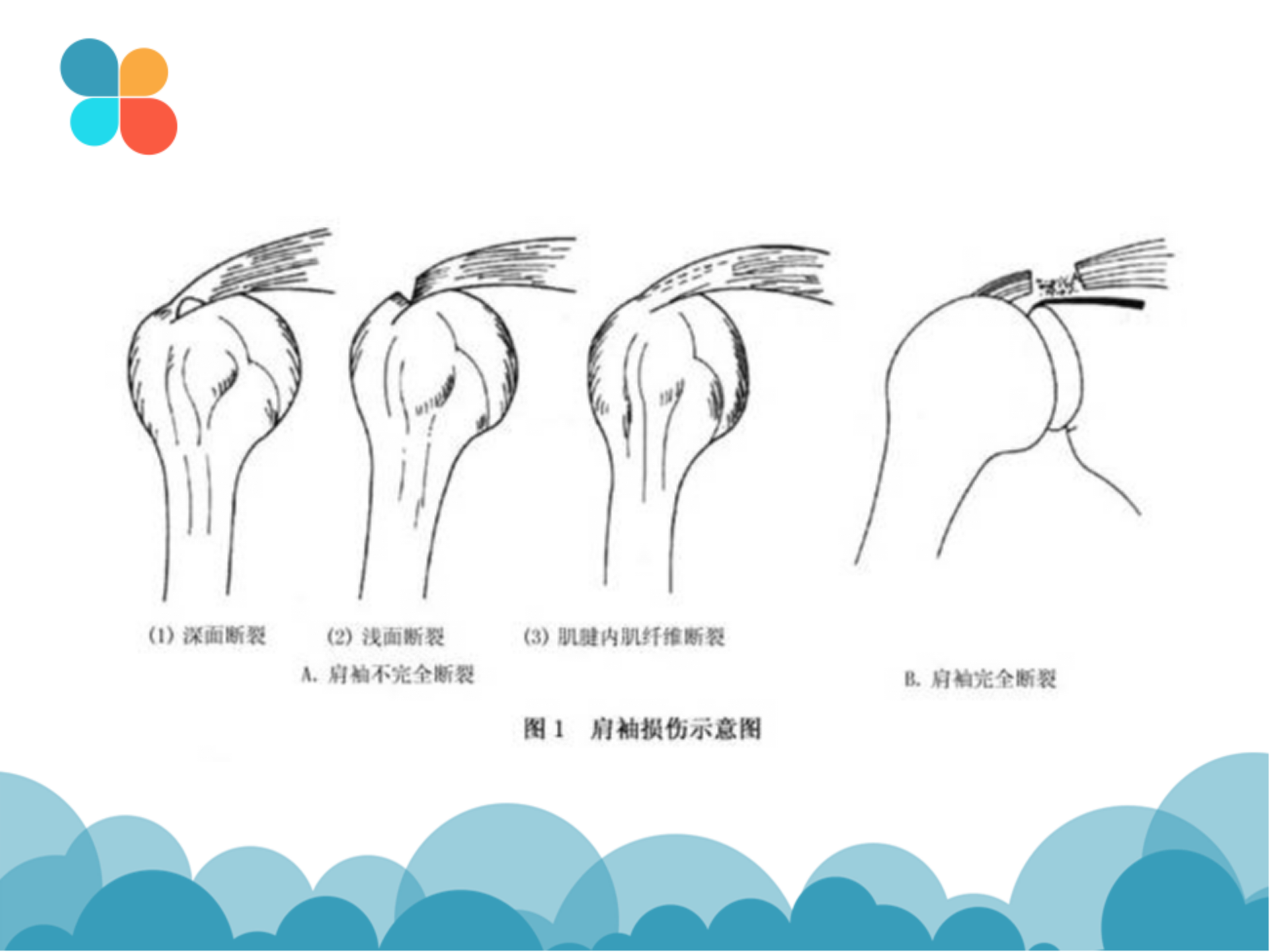 肩袖解剖LY_30.png