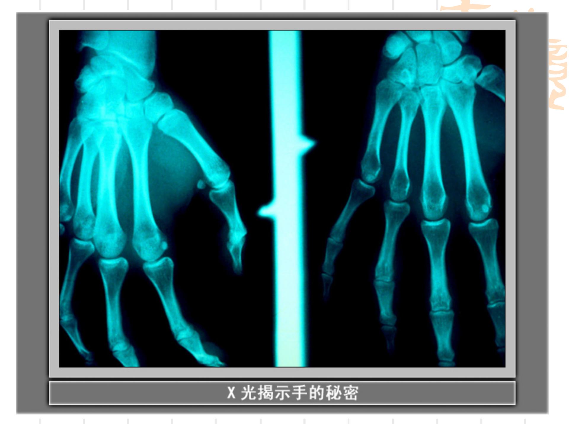骨骼关节肌肉_09.png