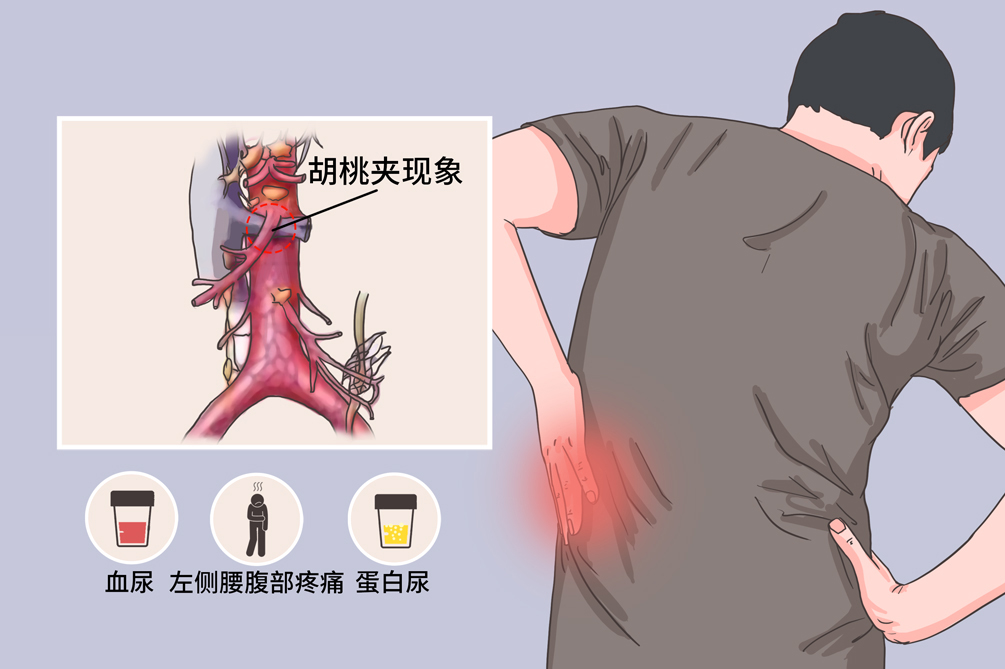 F037CEB4F68A0BC5036F80ADC1C0BD87.jpg