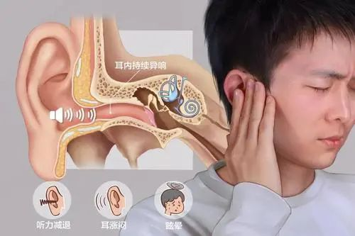 耳鸣知多少！